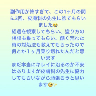 日本酒の化粧水 高保湿/菊正宗/化粧水を使ったクチコミ（8枚目）