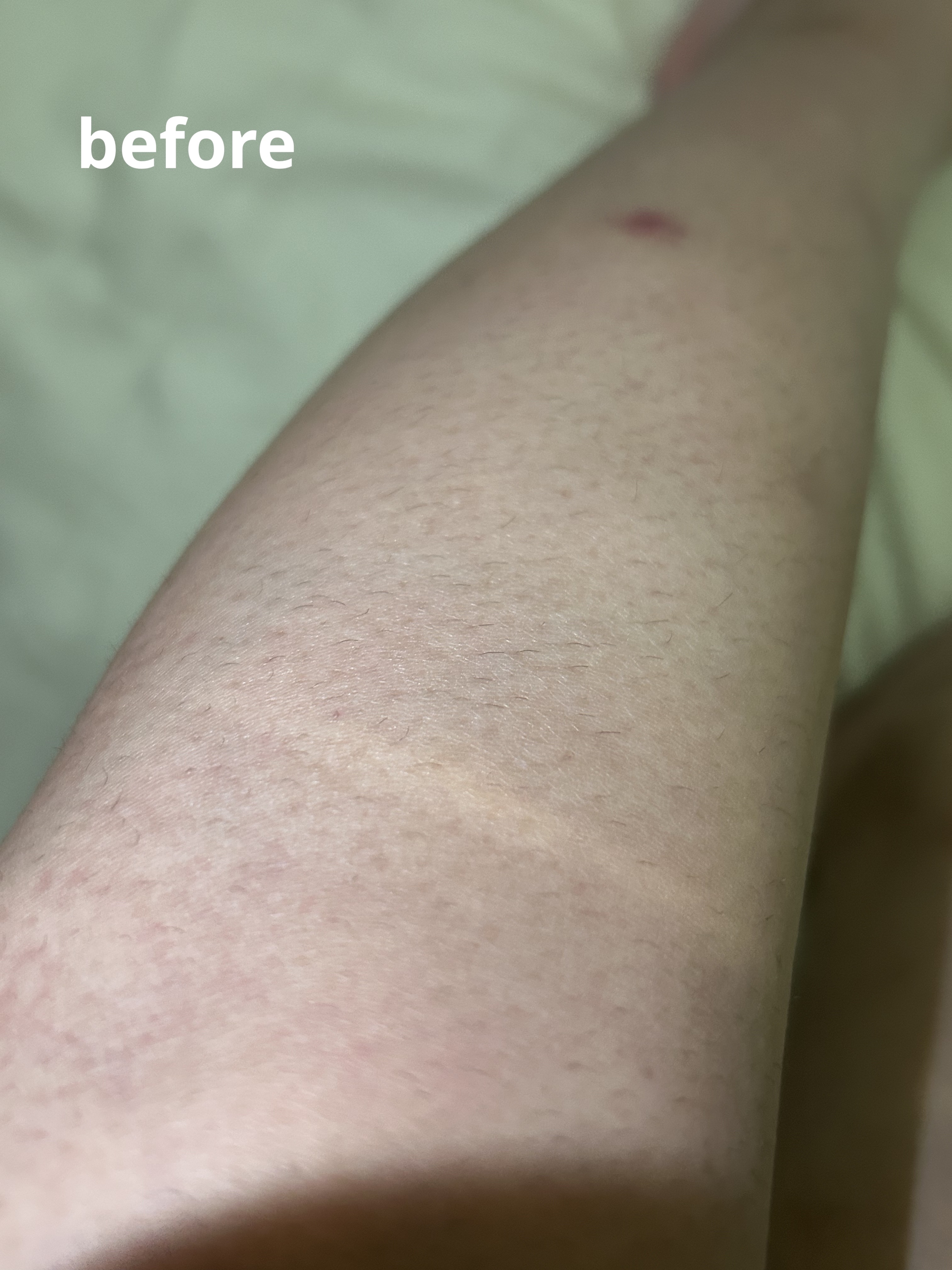 サロンプラス エンザイム ボディ シェービングエマルジョン/サロンプラス/ムダ毛ケアを使ったクチコミ（2枚目）