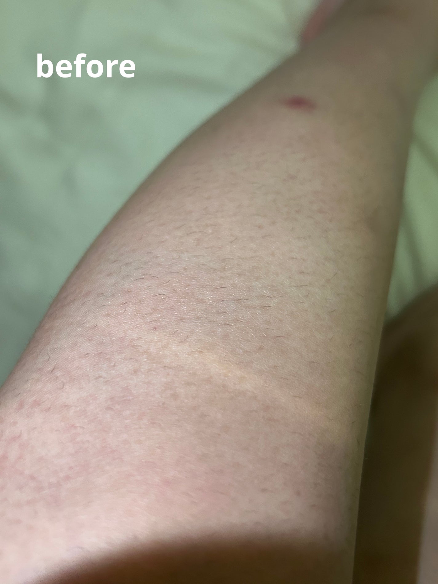 サロンプラス エンザイム ボディ シェービングエマルジョン/サロンプラス/ムダ毛ケアを使ったクチコミ(2枚目)