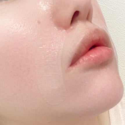 クリアターン ヒアロチューン マイクロパッチ 1500/クリアターン/シートマスク・パックを使ったクチコミ(5枚目)