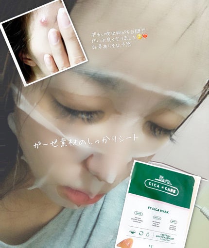 VT CICA マスク/VT/シートマスク・パックを使ったクチコミ(3枚目)