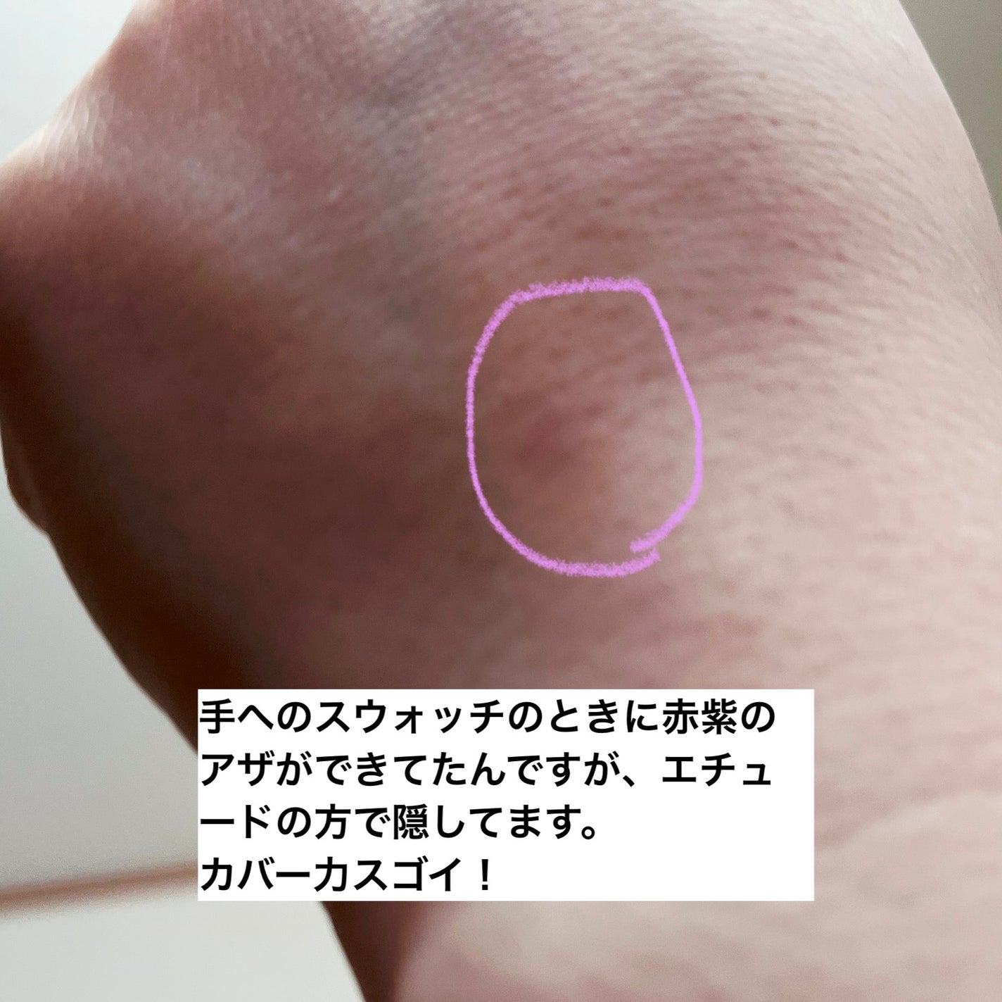 ビッグカバーフィットコンシーラー/ETUDE/リキッドコンシーラーを使ったクチコミ(7枚目)