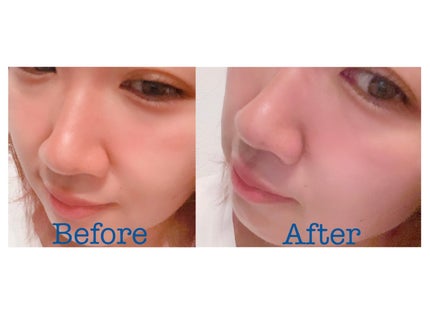 チョコブラ スペシャル毛穴ケアセット/Chocobra/スキンケアキットを使ったクチコミ(7枚目)