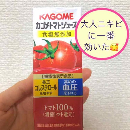 ペアアクネクリームW(医薬品)/ペア/その他を使ったクチコミ(1枚目)