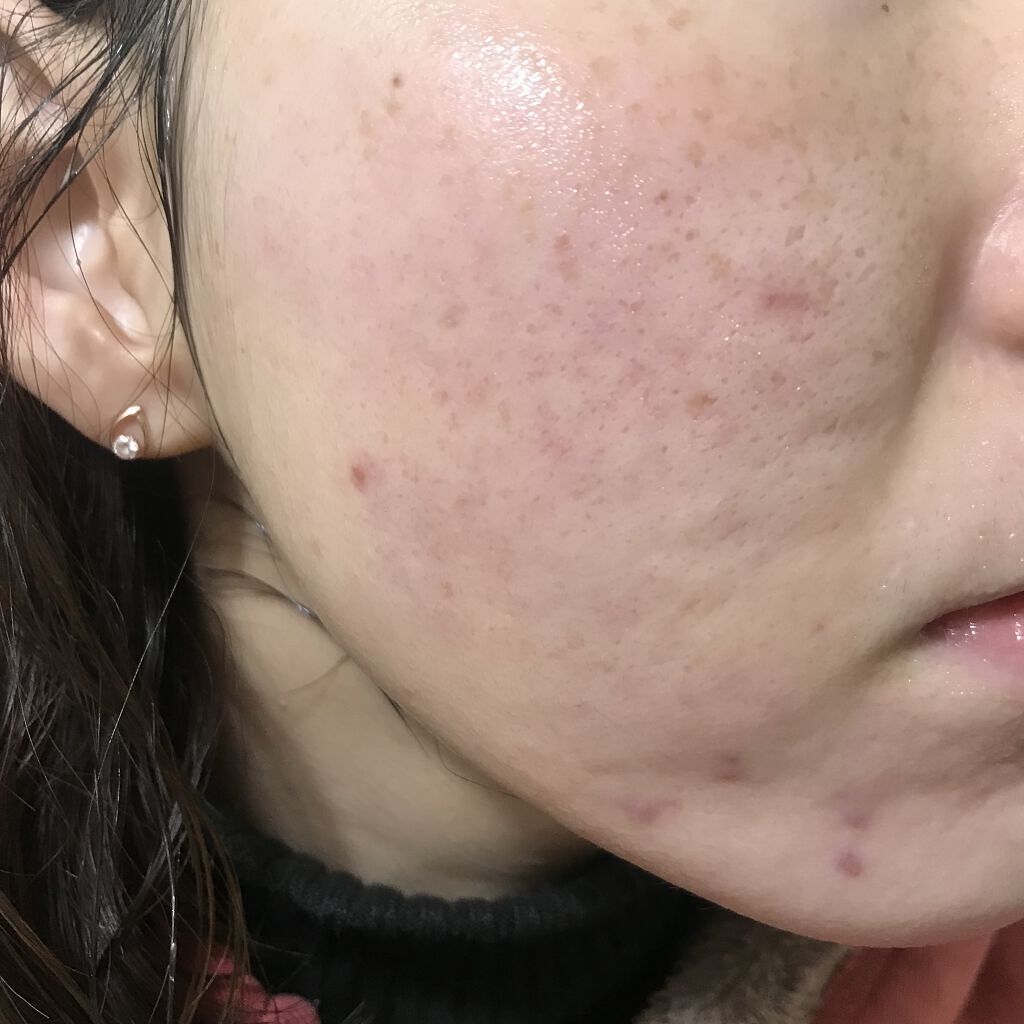 N by ONLY MINERALS ミネラルグロウスムーザー 01 PURE/ONLY MINERALS/化粧下地を使ったクチコミ（1枚目）