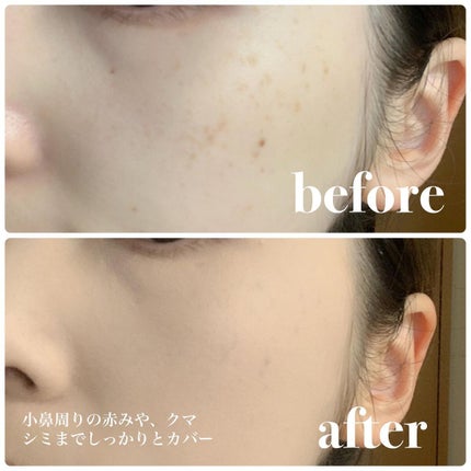 chichannnnð§žãã©ãã100 on LIPS ãâïžãã¢ãã16HRããŠããŒãã¡ã³ããŒã·ã§ã³ãªã¥ã¯ã¹ããã©ãŒã..ãïŒ10æç®ïŒ