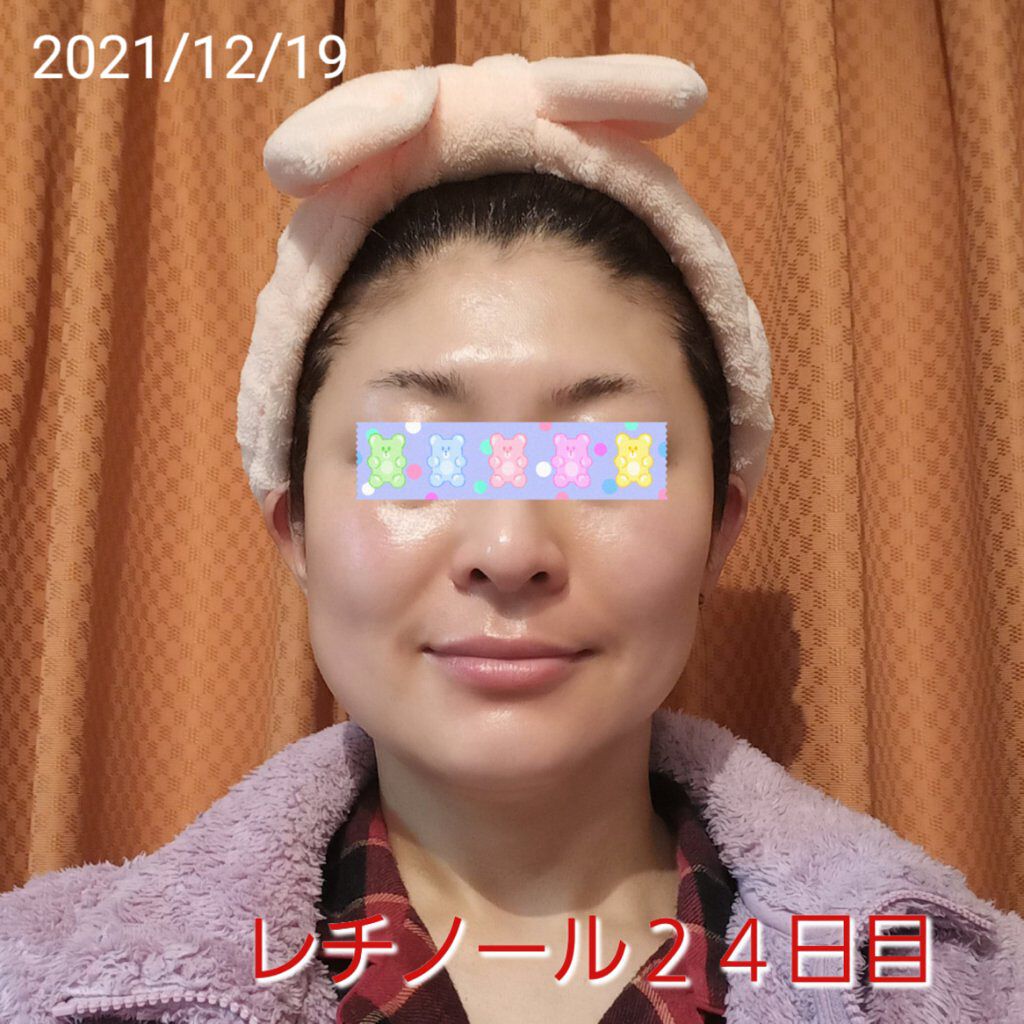 モイスチャーバーム ジャー/キュレル/フェイスクリームを使ったクチコミ（1枚目）