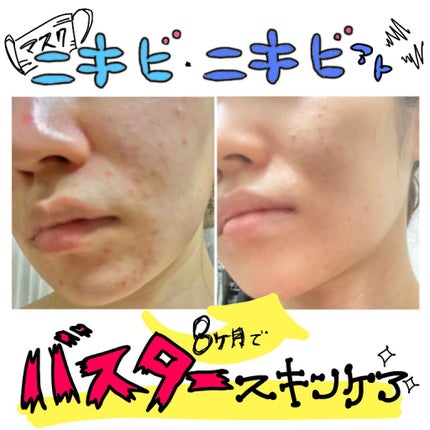 ザ・タイムR アクア/IPSA/化粧水を使ったクチコミ(1枚目)