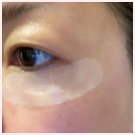 クリアターン ヒアロチューン マイクロパッチ 1500/クリアターン/シートマスク・パックを使ったクチコミ(4枚目)