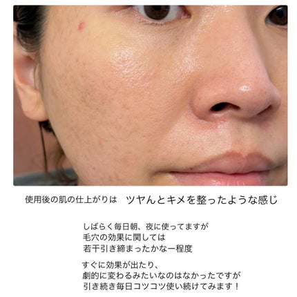 ガラクトポアセラム/SAM'U/美容液を使ったクチコミ(8枚目)