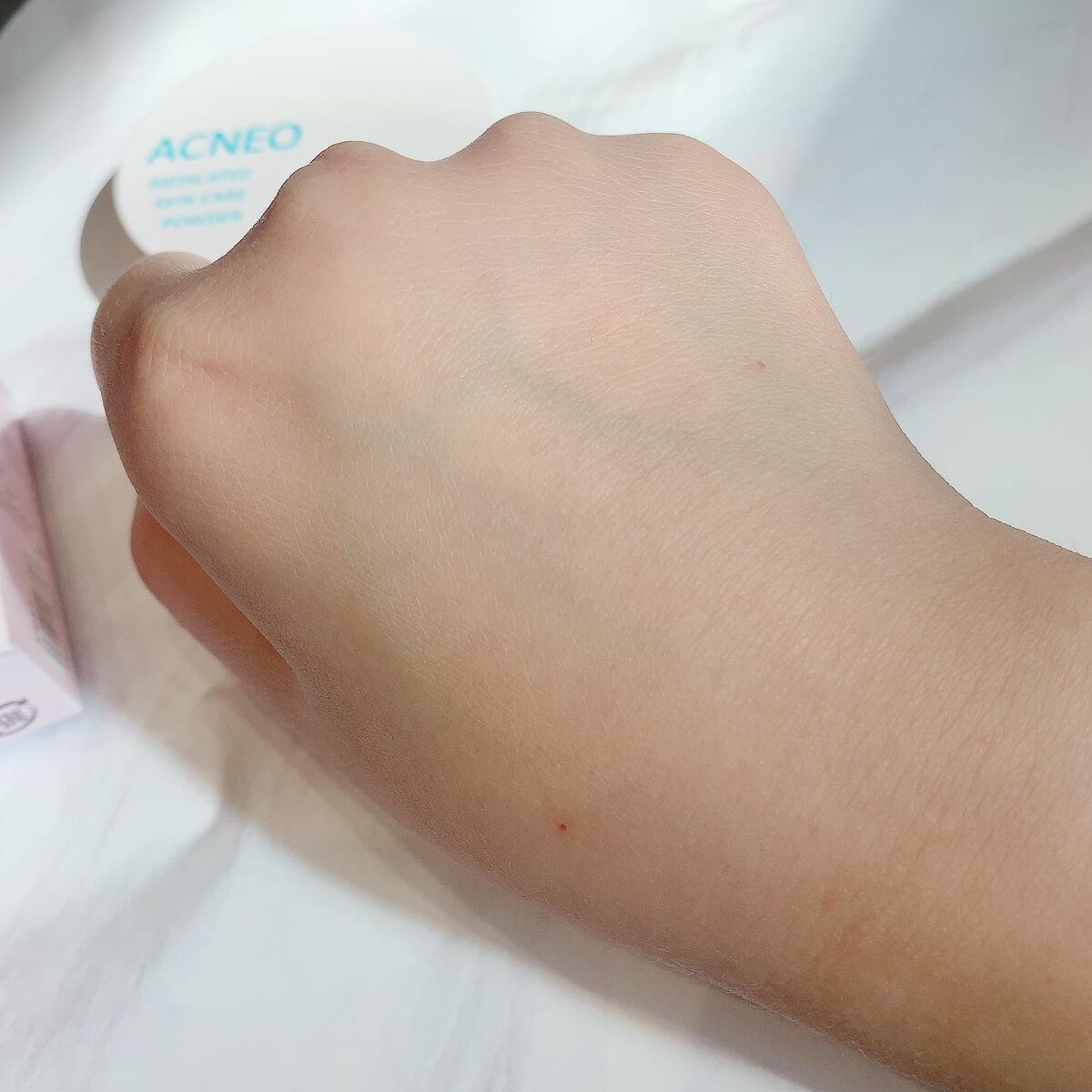 薬用 スキンケア パウダー/アクネオ/プレストパウダーを使ったクチコミ(4枚目)