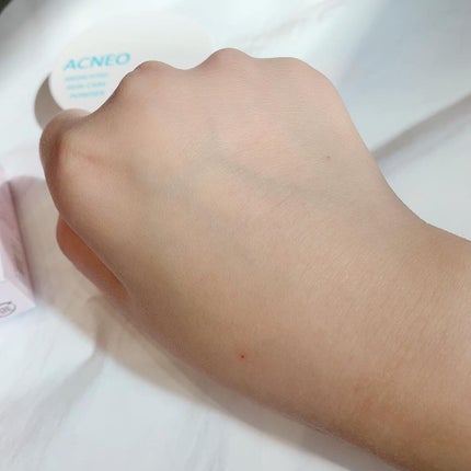 薬用 スキンケア パウダー/アクネオ/プレストパウダーを使ったクチコミ(4枚目)
