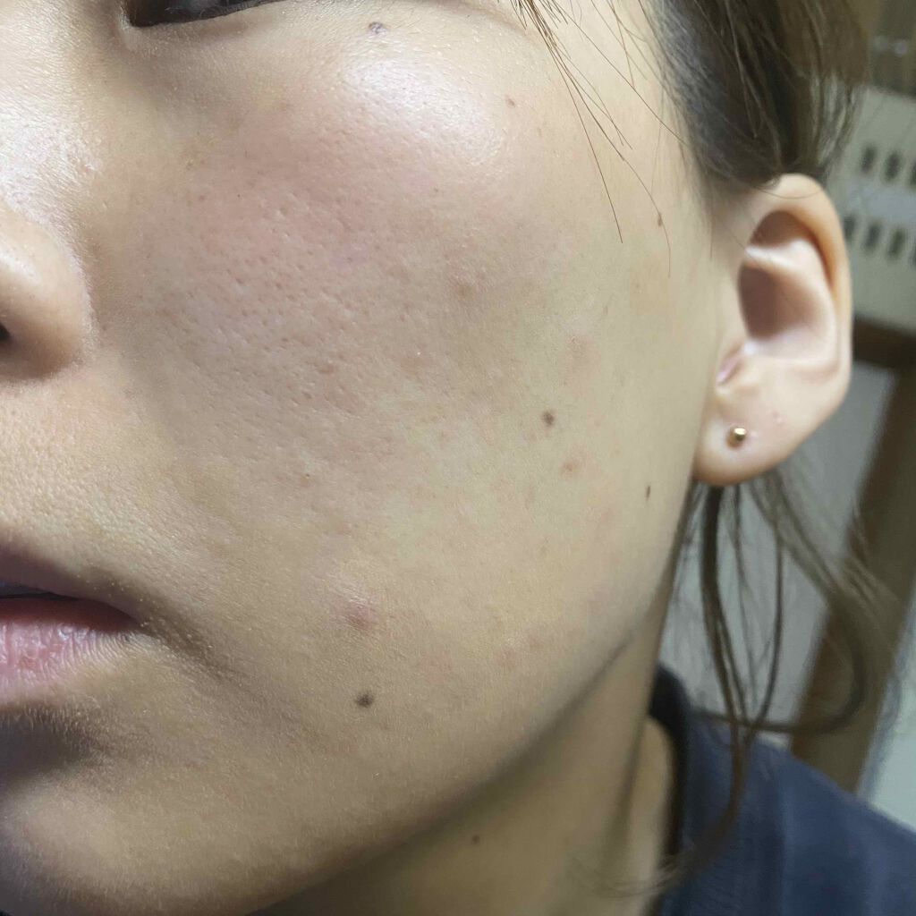 UVファンデーション EXプラス/CEZANNE/パウダーファンデーションを使ったクチコミ（2枚目）