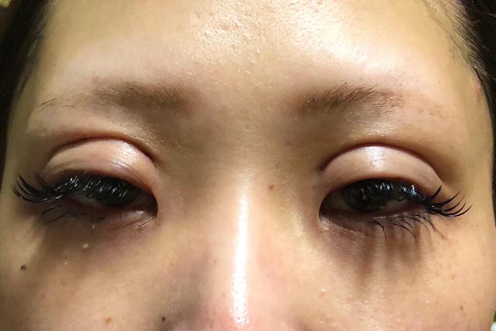 aikam on LIPS 「メイク動画upする前に…私、2回、整形しております。1回目20..」(2枚目)