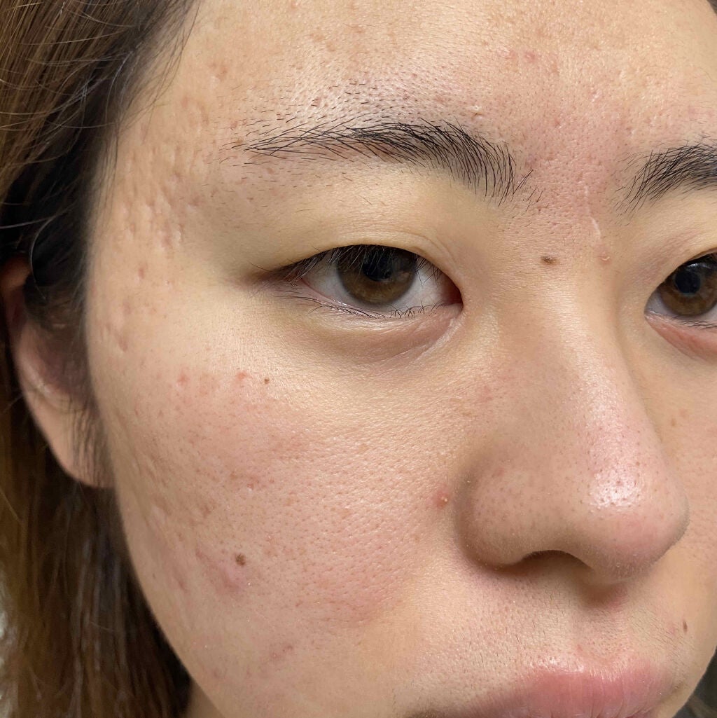 化粧水・敏感肌用・しっとりタイプ/無印良品/化粧水を使ったクチコミ(2枚目)