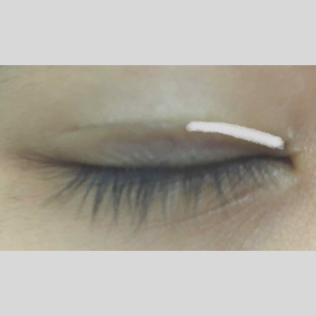 アイビューティー フィクサー WP/アストレア ヴィルゴ/二重まぶた用アイテムを使ったクチコミ(4枚目)