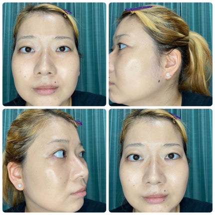 スタジオフィックス フルイッド SPF 15/M・A・C/リキッドファンデーションを使ったクチコミ(6枚目)