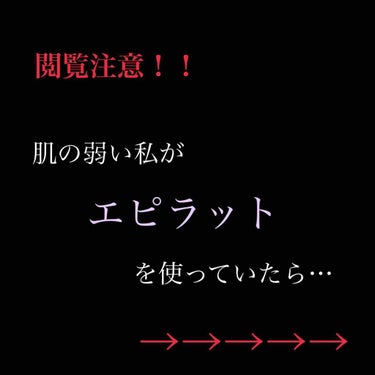 エピラット 除毛クリームのクチコミ「⚠️商品を間違えてしまったため再投稿

皆様、初めまして
まつむらと申します。


私は大学生.....」（1枚目）