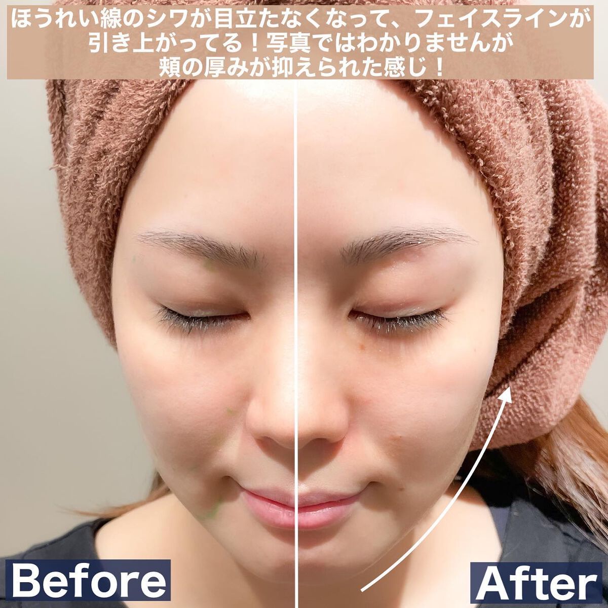 Riho | 集英社MAQUIAエキスパート on LIPS 「美容医療デビューしてきました✨先日オープン前の内覧会にお邪魔し..」(5枚目)