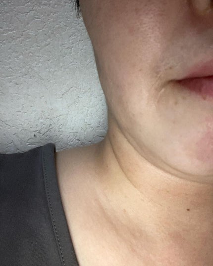 にゃんこ on LIPS 「ホワイトニング ブラック マスク試してみました。新感覚のシミ、..」(6枚目)