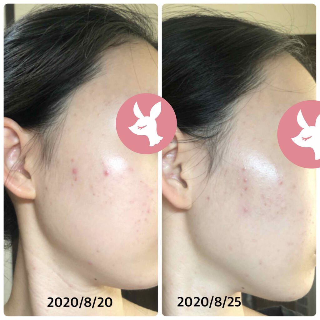 潤浸保湿 乳液/キュレル/乳液を使ったクチコミ(2枚目)