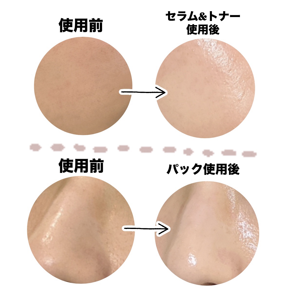 ティーツリーC鼻パック/BRING GREEN/シートマスク・パックを使ったクチコミ（2枚目）