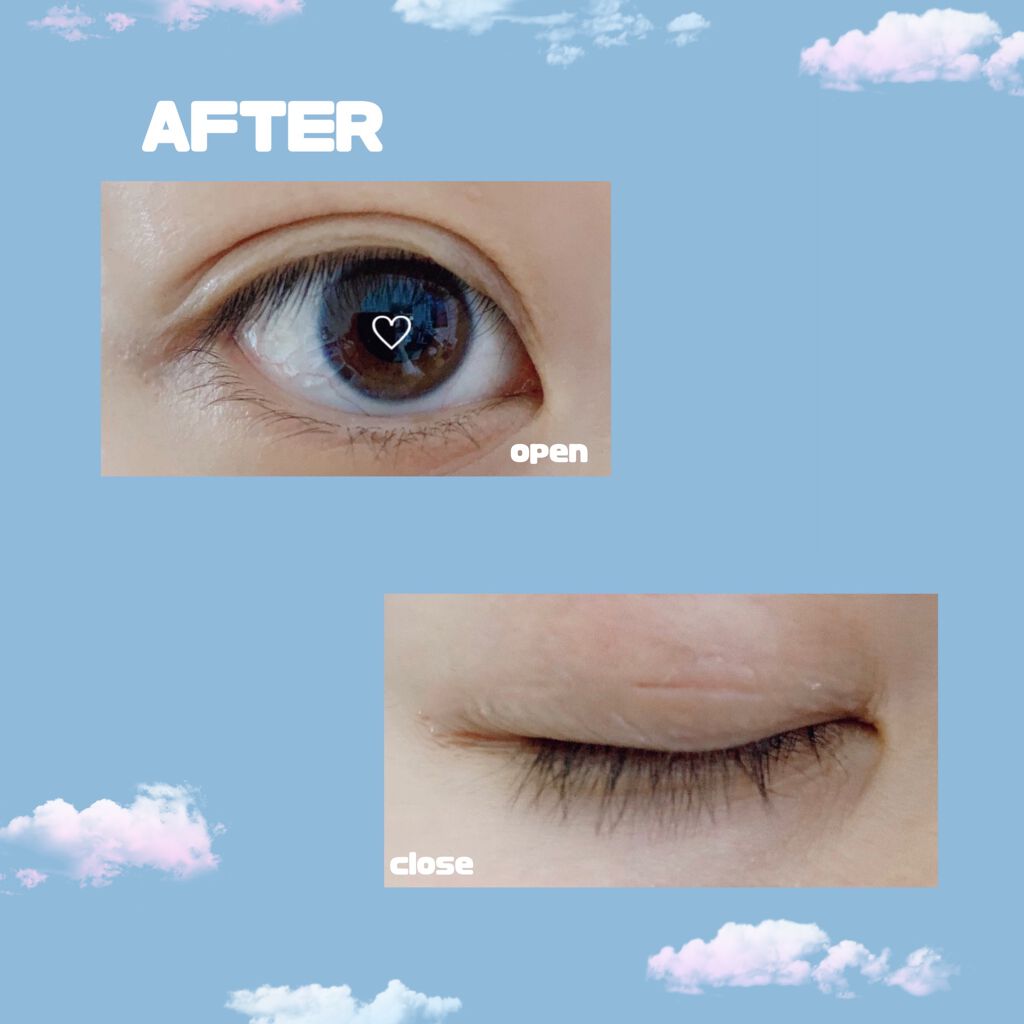 オリシキ アイリッドスキンフィルム		/D-UP/二重まぶた用アイテムを使ったクチコミ（3枚目）