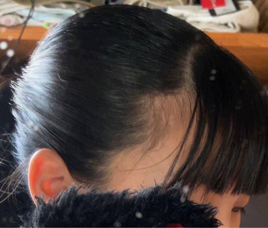 パピ on LIPS 「※写真は全てネットからです🙏🙏綺麗なポニーテールを作るためにダ..」(4枚目)