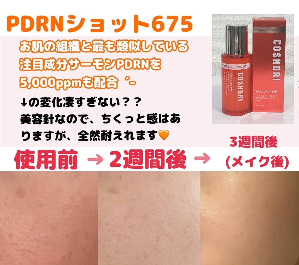 PDRNショット675/COSNORI/美容液を使ったクチコミ(2枚目)