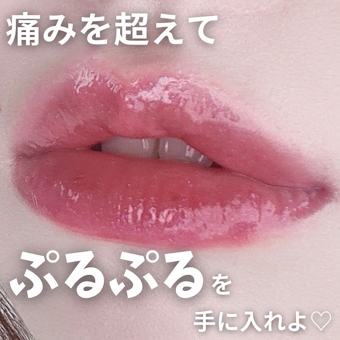 オールマイシングス トゥルービューティ キス リッププランパー/all my things/リッププランパーを使ったクチコミ（1枚目）