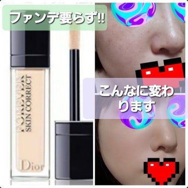 【旧】ディオールスキン フォーエヴァー スキン コレクト コンシーラー/Dior/リキッドコンシーラーを使ったクチコミ（1枚目）