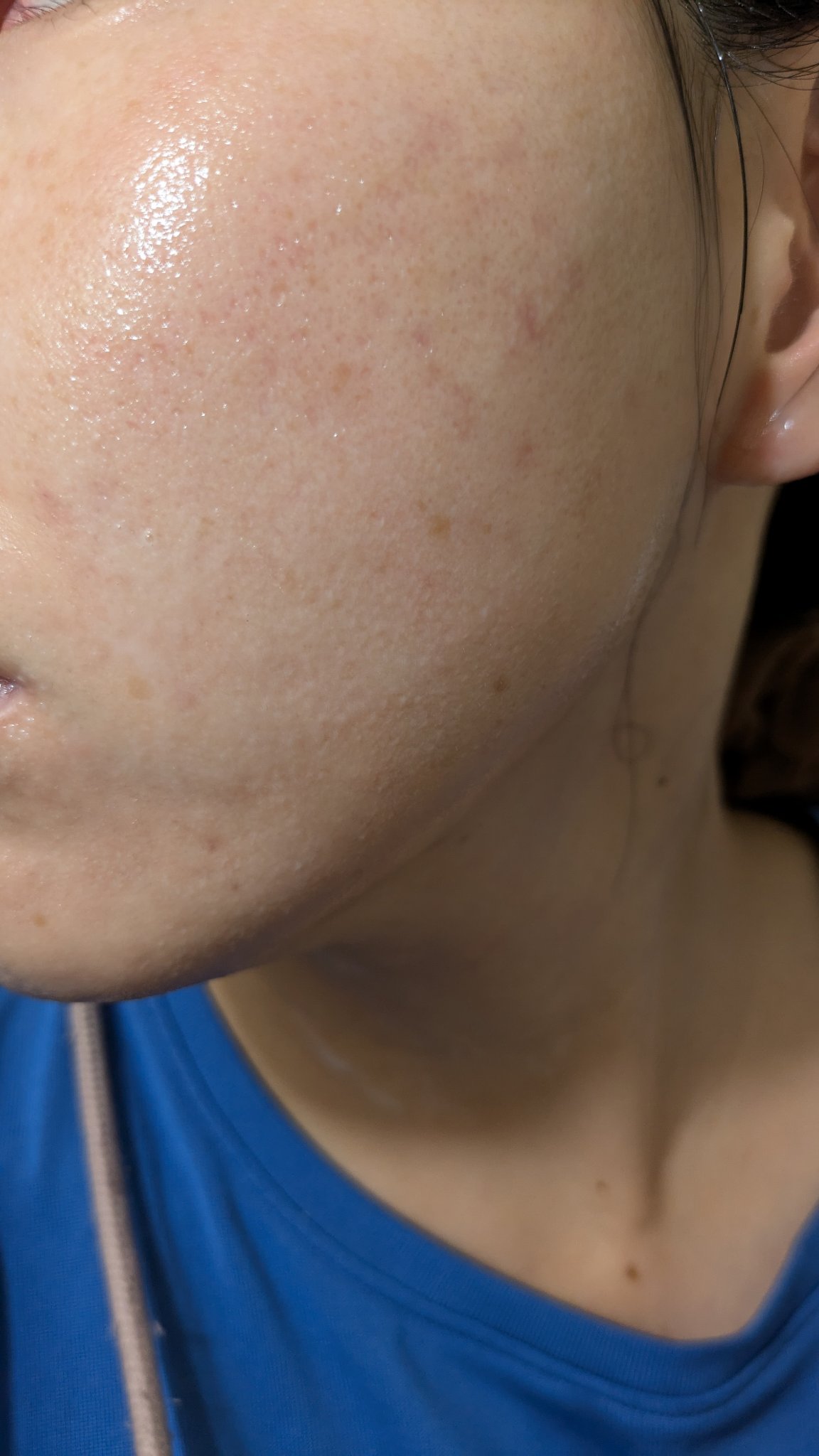 A2+NAG2ソリューション/The Ordinary/美容液を使ったクチコミ（2枚目）