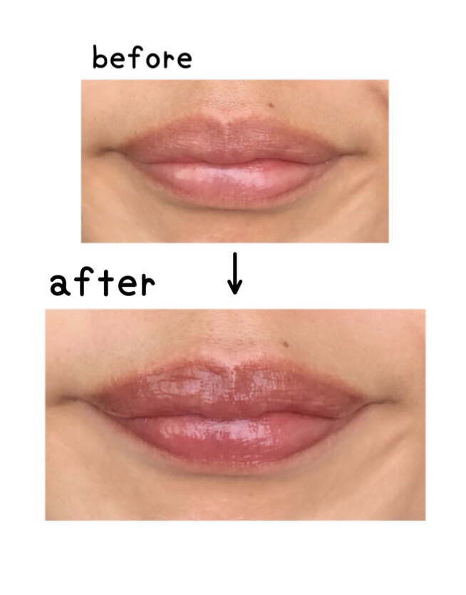 プランピーリップ/Fujiko/リップグロスを使ったクチコミ（3枚目）