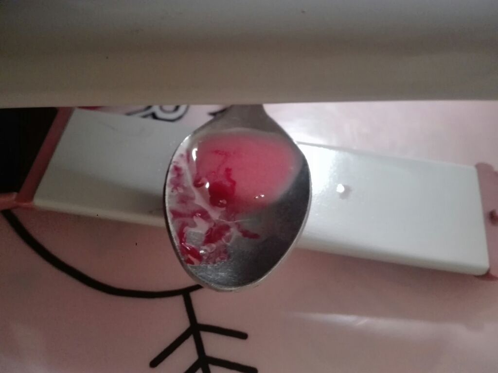 薬用リップスティックXD/メンソレータム/リップクリームを使ったクチコミ（3枚目）