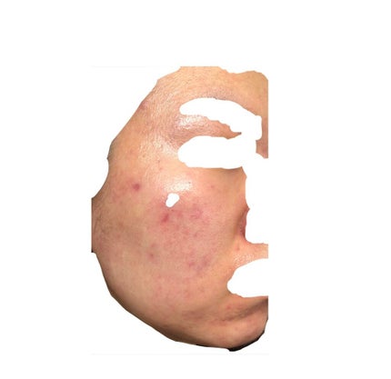 ベジータ on LIPS 「今週の肌 1.23ディフェリンゲル塗っても全然毛穴出てくれなく..」(4枚目)