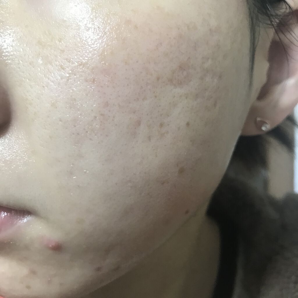 ビオオイル アルガンオイル/Melvita/フェイスオイルを使ったクチコミ（2枚目）