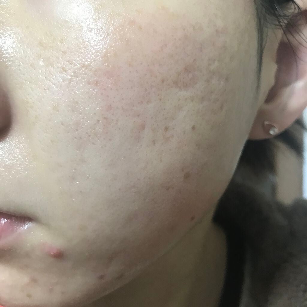 ビオオイル アルガンオイル/Melvita/フェイスオイルを使ったクチコミ(2枚目)