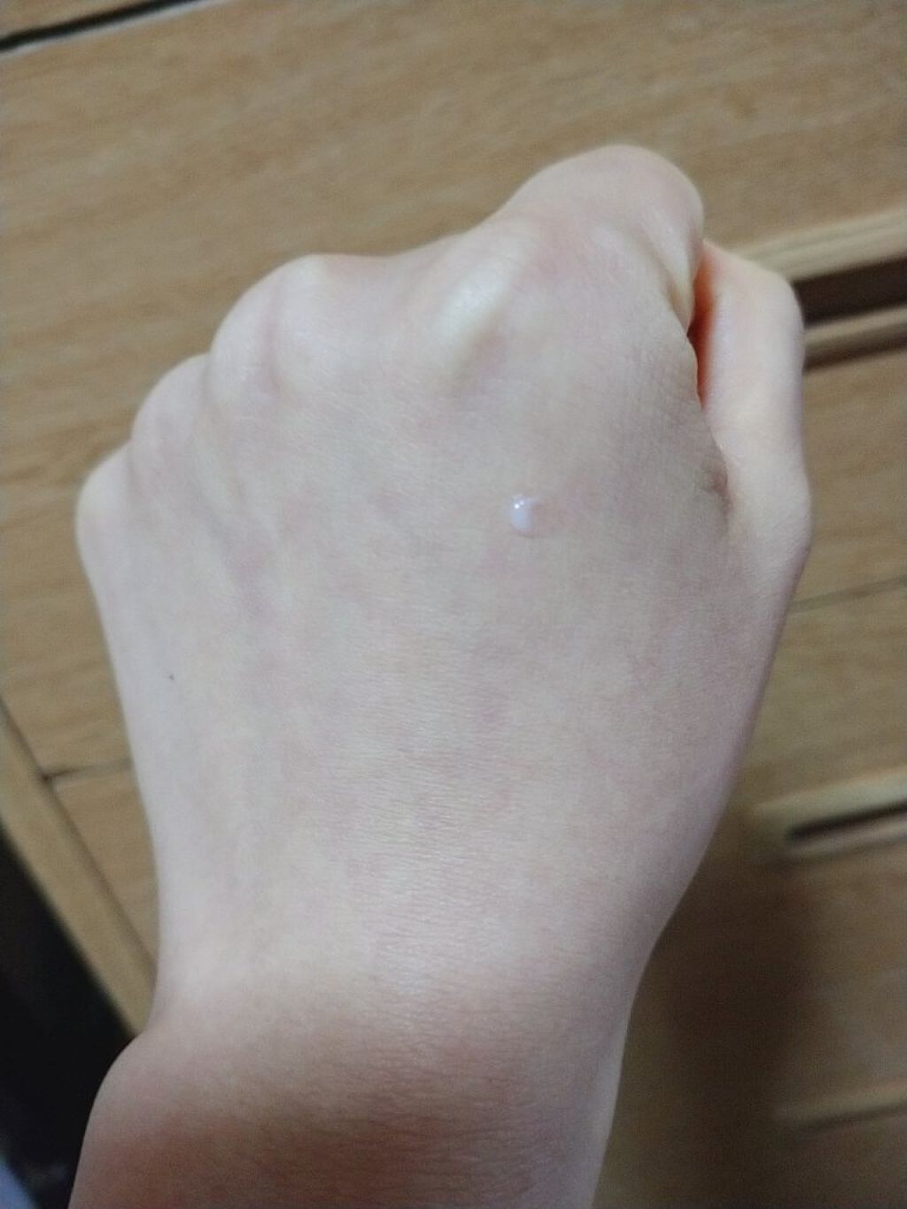 センテラスカ軟膏/NOTS/その他スキンケアを使ったクチコミ（2枚目）