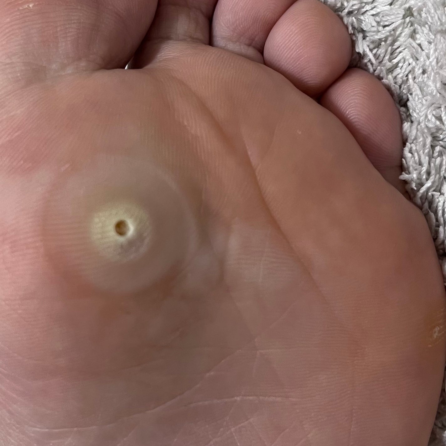 べっぴんはとむぎ/タマチャンショップ/食品を使ったクチコミ(3枚目)