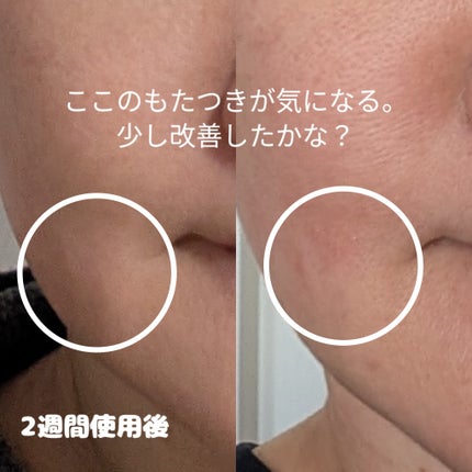 9番 NMNバイオリフト濃縮美容液/numbuzin/美容液を使ったクチコミ(3枚目)