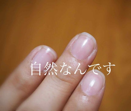 ネイルエンビー/O・P・I/ネイルオイル・トリートメントを使ったクチコミ(2枚目)