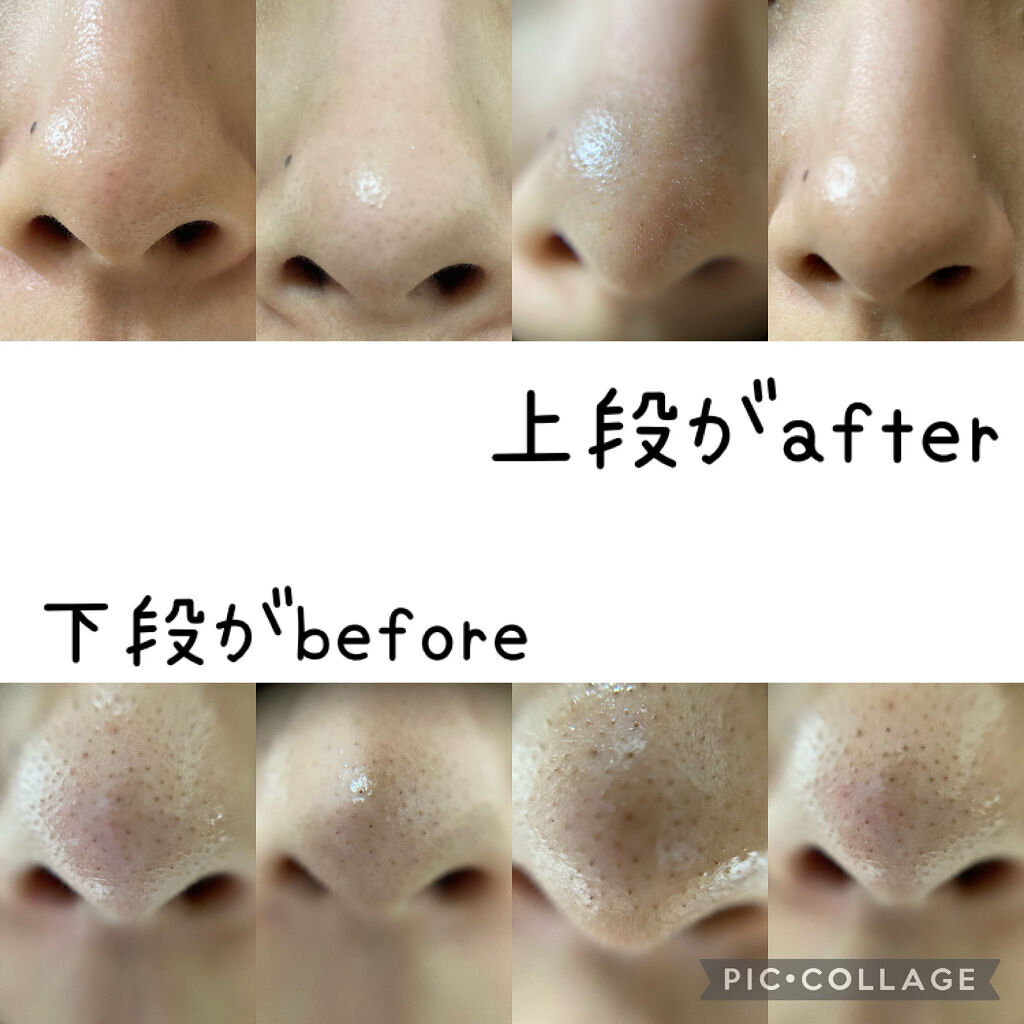 デュオ ザ クレンジングバーム ブラック/DUO/クレンジングバームを使ったクチコミ（2枚目）