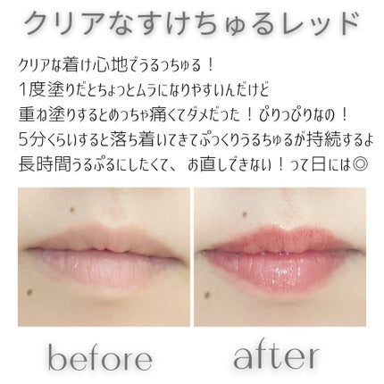 ドトムリッププラスプランパー/keybo/リッププランパーを使ったクチコミ(3枚目)