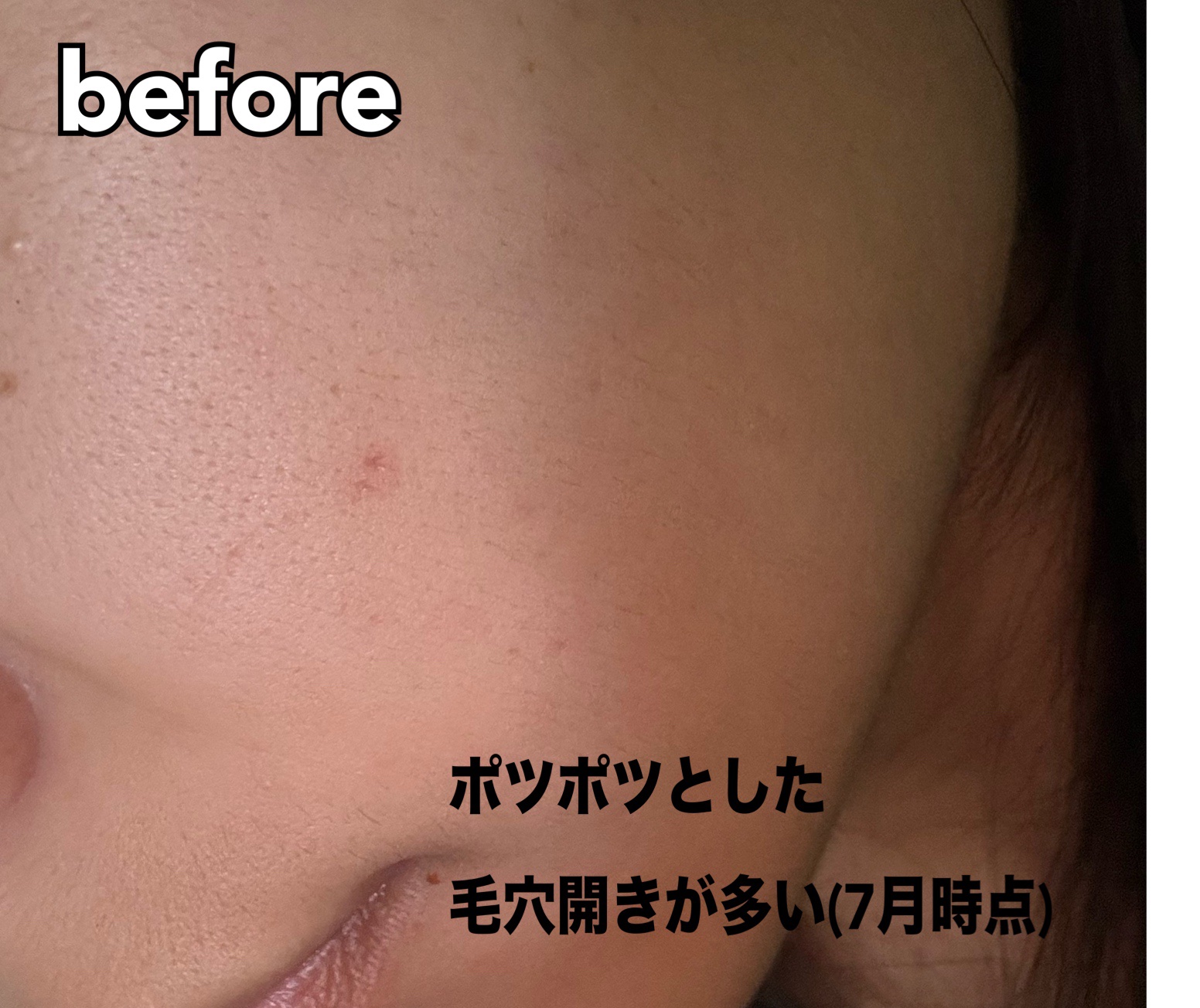 1番 塗るパントテン酸スージングクリーム/numbuzin/フェイスクリームを使ったクチコミ（2枚目）