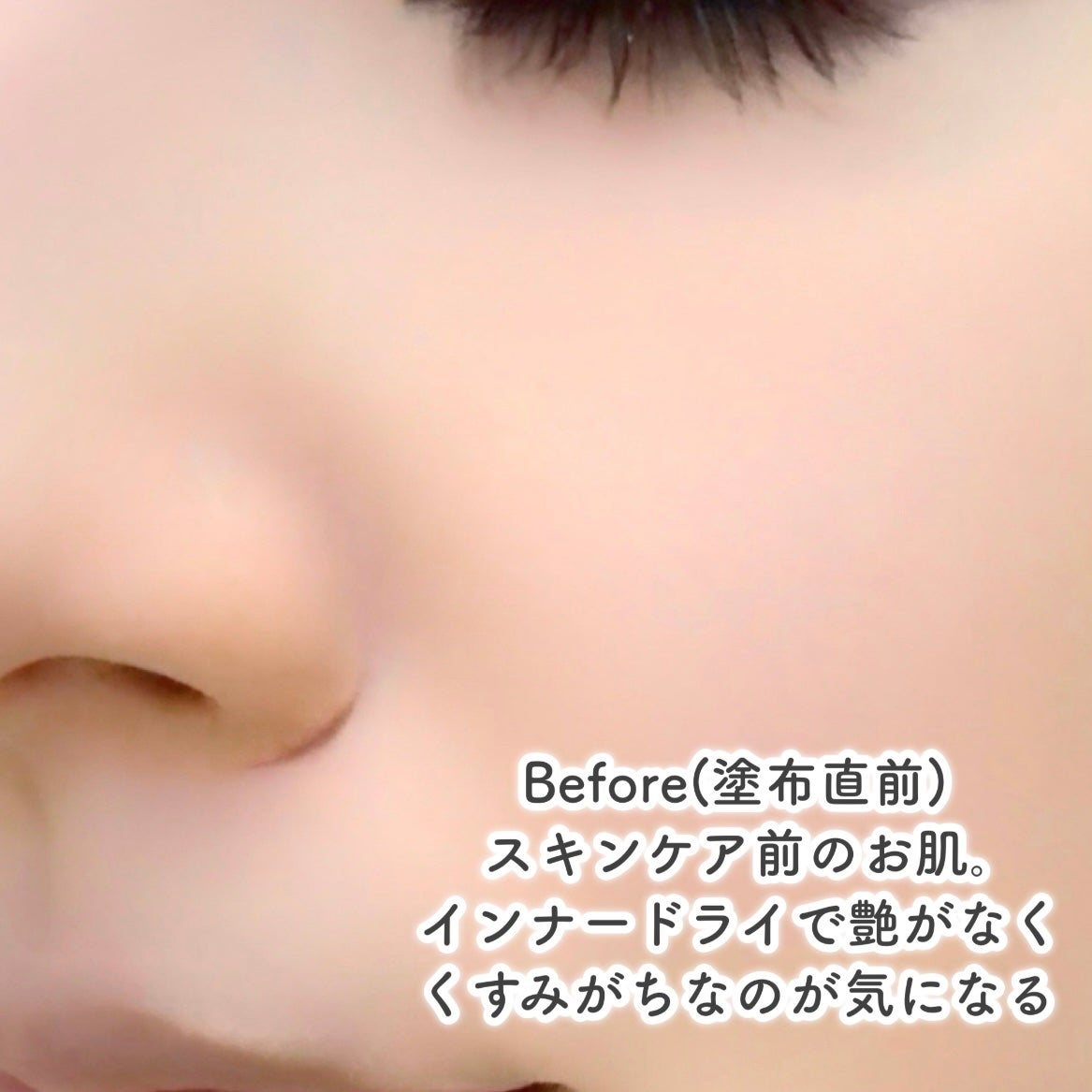 グルカミューンクリーム/VT/フェイスクリームを使ったクチコミ(4枚目)