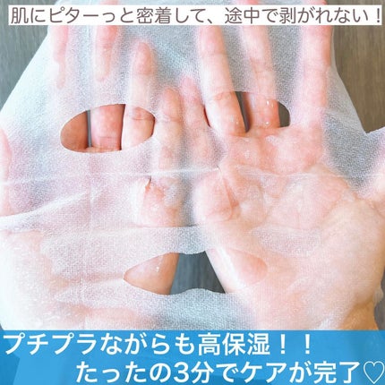 ダーマレーザースーパーVC100マスク/クオリティファースト/シートマスク・パックを使ったクチコミ(6枚目)