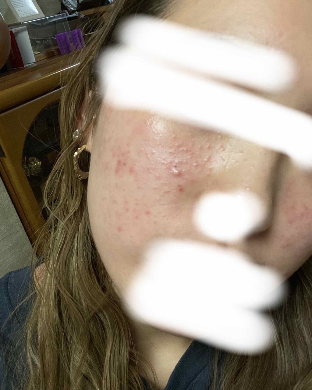 薬用保湿化粧水/オードムーゲ/化粧水を使ったクチコミ（3枚目）