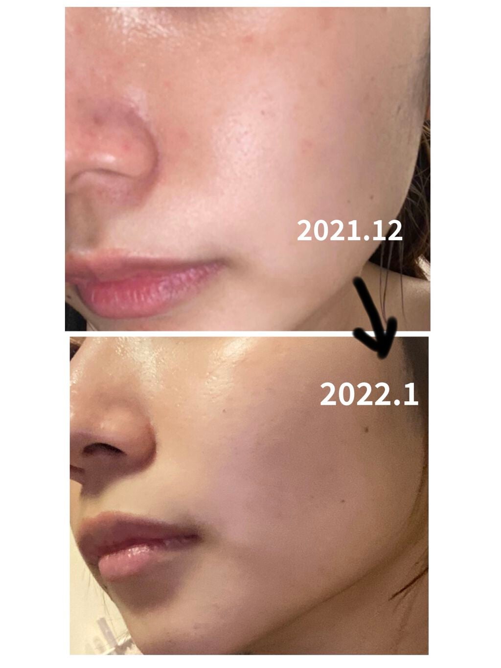 ニベアクリーム/ニベア/ボディクリームを使ったクチコミ(2枚目)