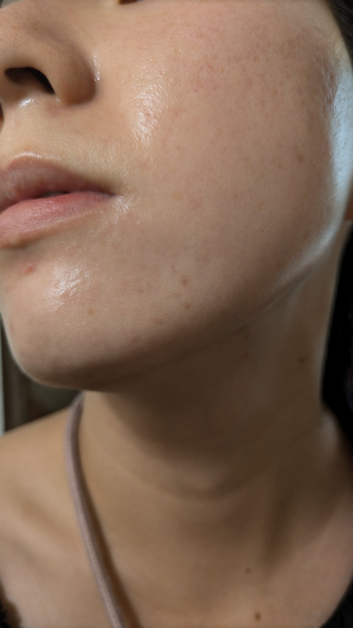 A2+NAG2ソリューション/The Ordinary/美容液を使ったクチコミ（2枚目）