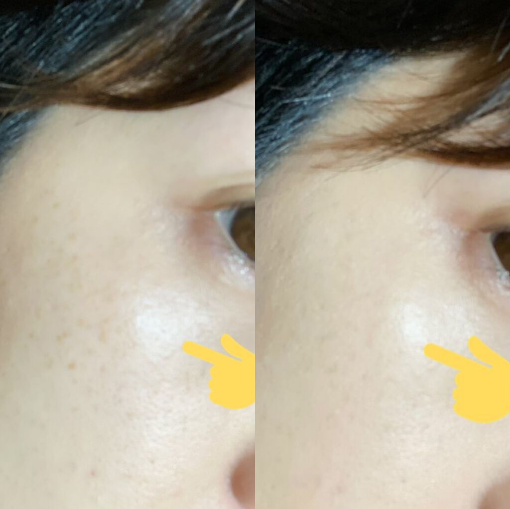 マイコンシーラー ワイド カバー/innisfree/リキッドコンシーラーを使ったクチコミ（3枚目）